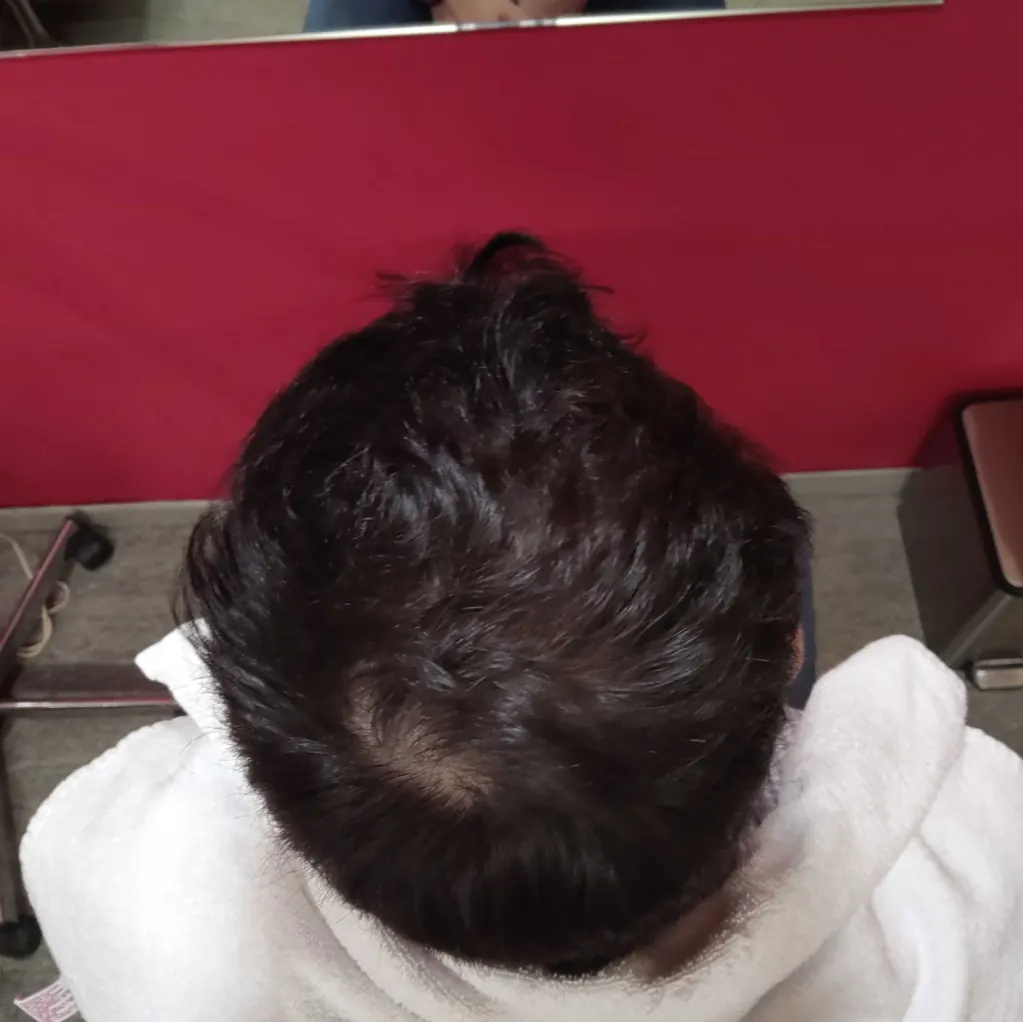 Antes y después 2