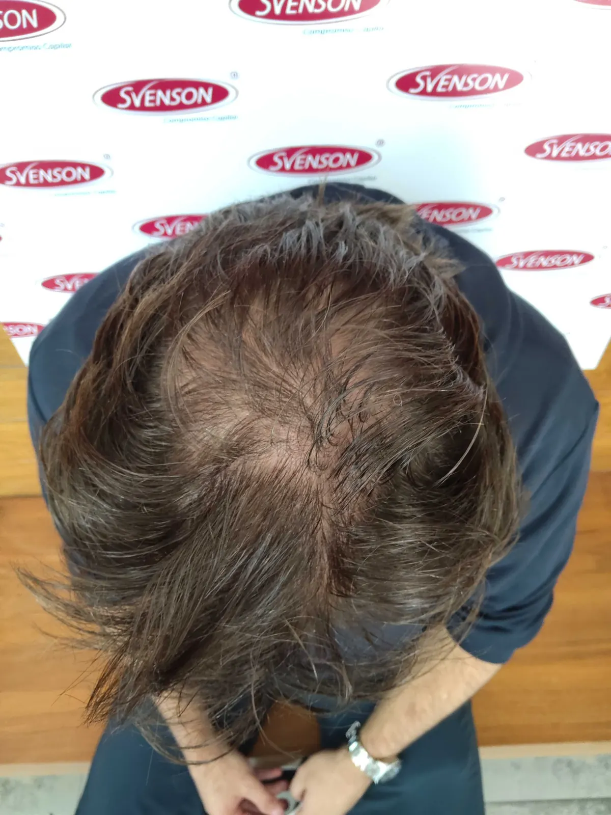 Antes