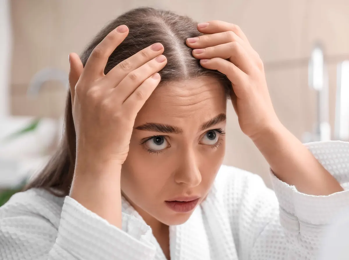 ¿Qué es la alopecia?