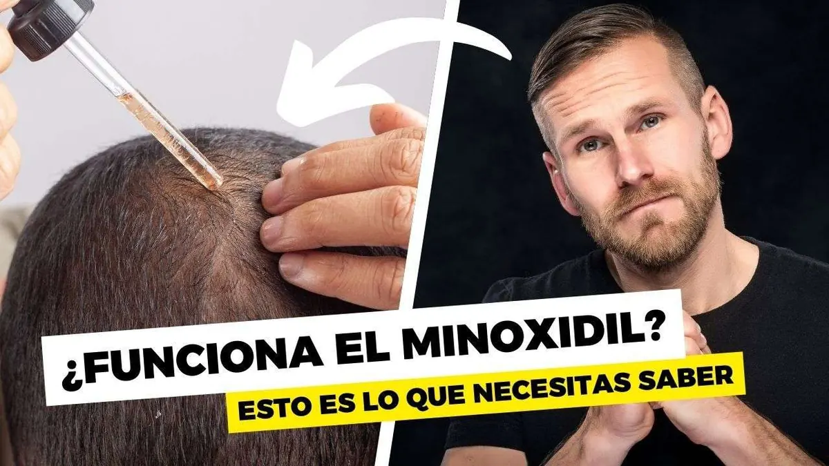 Frasco de minoxidil y aplicador para tratamiento capilar